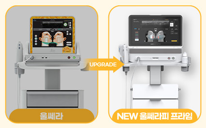 기존 울쎄라와 NEW 울쎄라피 프라임 장비 비교
