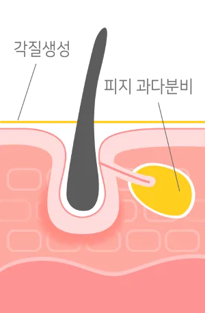 Step 01