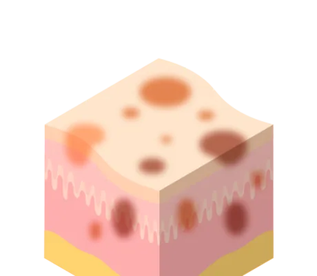 코코레이저