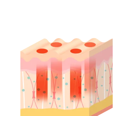 CO2프락셀